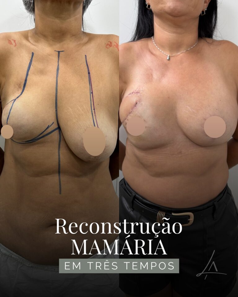 Instagram post from dr.leandrodeaquino. This post is in position 14.