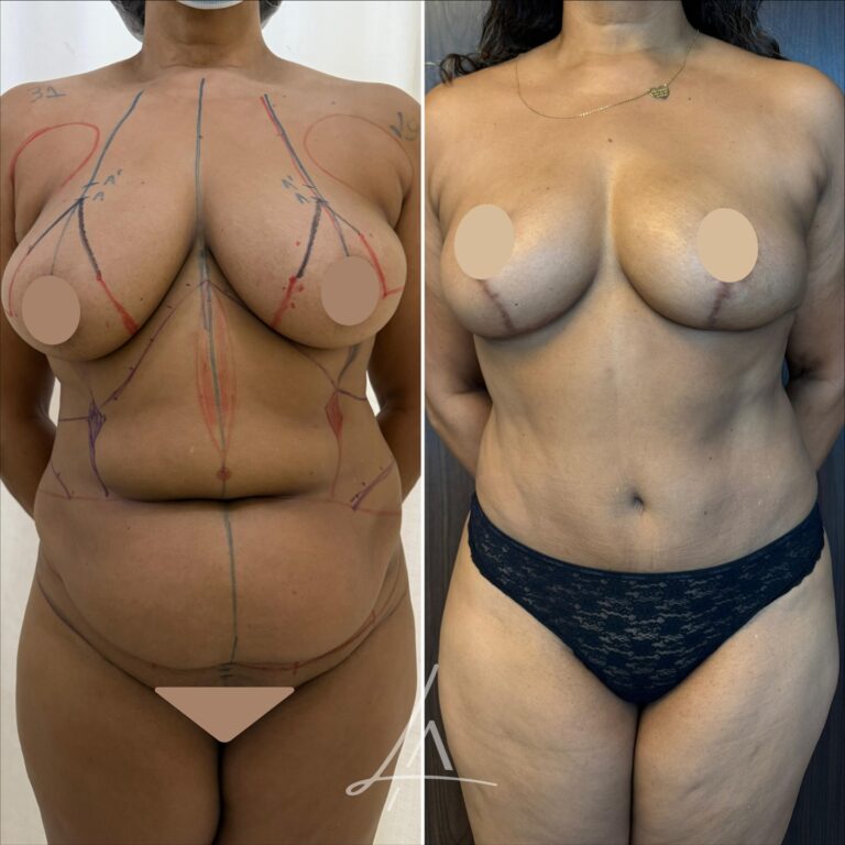 Instagram post from dr.leandrodeaquino. This post is in position 9.