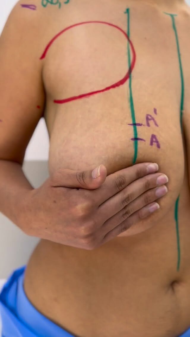 Instagram post from dr.leandrodeaquino. This post is in position 2.