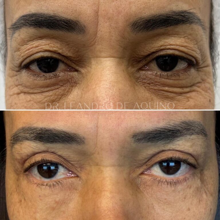 Instagram post from dr.leandrodeaquino. This post is in position 15.