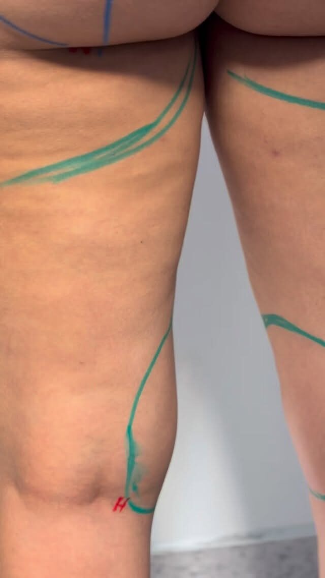 Instagram post from dr.leandrodeaquino. This post is in position 11.